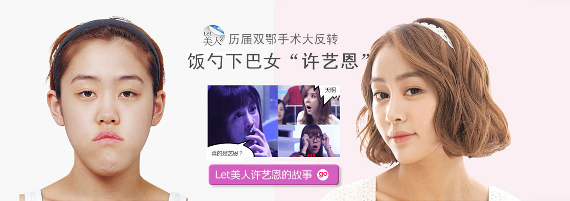 韩国ID整形医院参加let美人了吗 ?