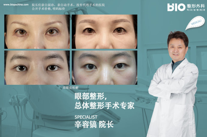 辛容镐院长眼部综合手术 辛容镐院长眼部综合手术