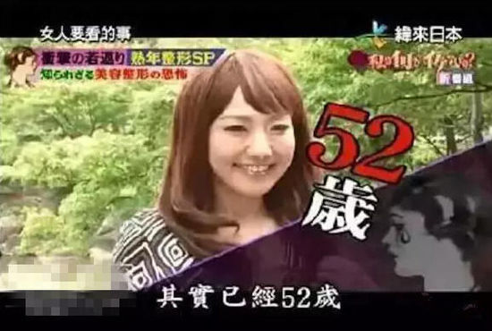 52岁大妈花450万整容成少女 拉皮法令纹填充双眼皮等20项