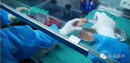 系统化阐述:自体脂肪移植在乳房整形中的应用 系统化阐述:自体脂肪移植在乳房整形中的应用