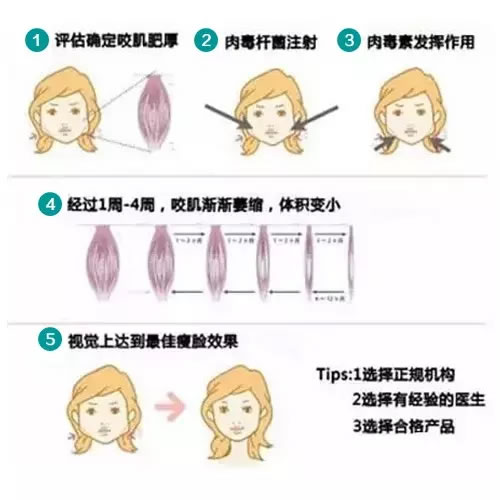 如何解决大饼脸 如何解决大饼脸