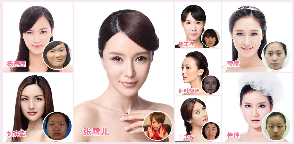 <!--<i data=20240710 data-id=13583></i>-->整形蝶变案例,有没有心动呢? <!--<i data=20240710 data-id=13583></i>-->整形蝶变案例,有没有心动呢?