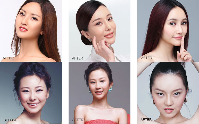 300万求美者在美莱惊艳蜕变 300万求美者在美莱惊艳蜕变