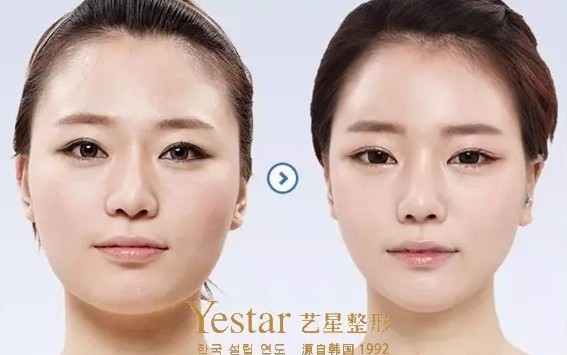 美国进口瘦脸 美国进口瘦脸