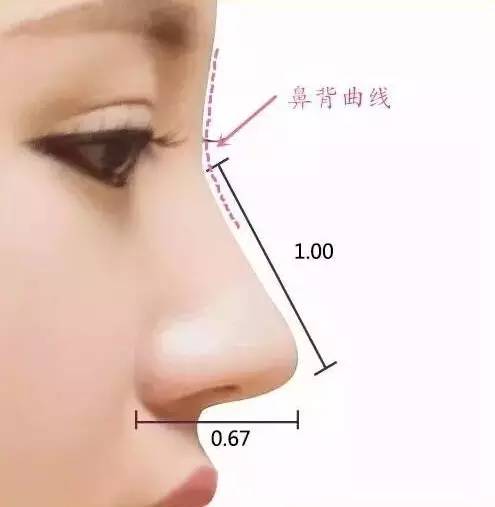 鼻整形,除了隆鼻,你还应该知道这些