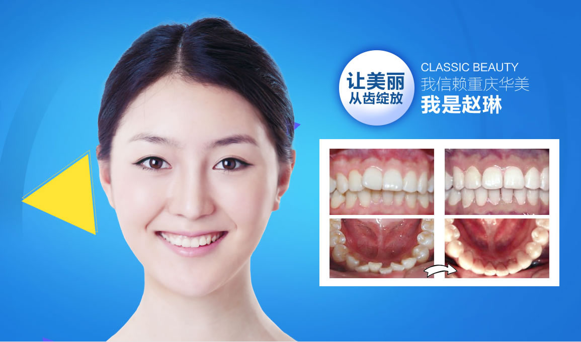 美容牙科 隐形矫正:8999/元 进口种植牙:4999/元 3D仿生瓷贴面:2600/元 钴铬美容冠:700/元 美容牙科 隐形矫正:8999/元 进口种植牙:4999/元 3D仿生瓷贴面:2600/元 钴铬美容冠:700/元