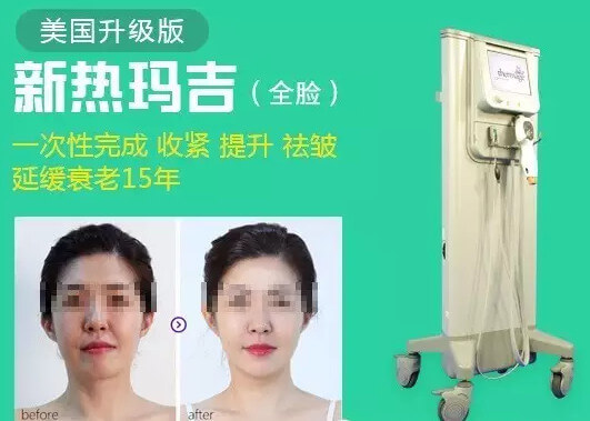 美国升级版新热玛吉全脸治疗效果对比 美国升级版新热玛吉全脸治疗效果对比
