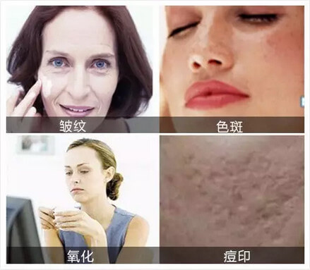 伊美尔童颜全面减龄 首次体验半价