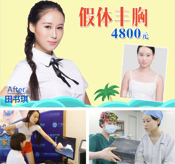 广州曙光隆胸4800元 广州曙光隆胸4800元
