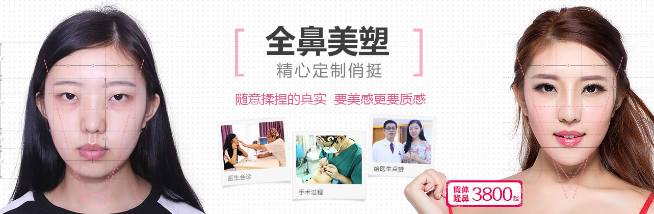 广州曙光假体隆鼻案例只要3800元 广州曙光假体隆鼻案例只要3800元