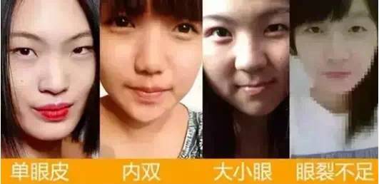 上海艺星月末双眼皮大优惠 价格立减5000元