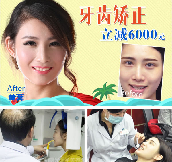 广州曙光牙齿矫正立减6000元 广州曙光牙齿矫正立减6000元