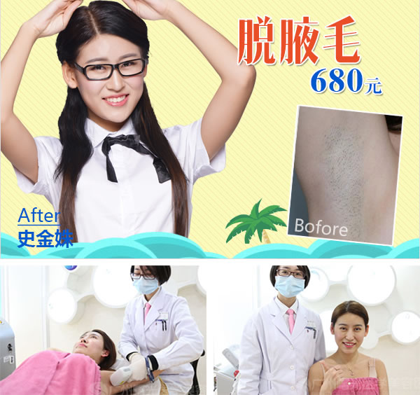广州曙光脱腋毛680元 广州曙光脱腋毛680元