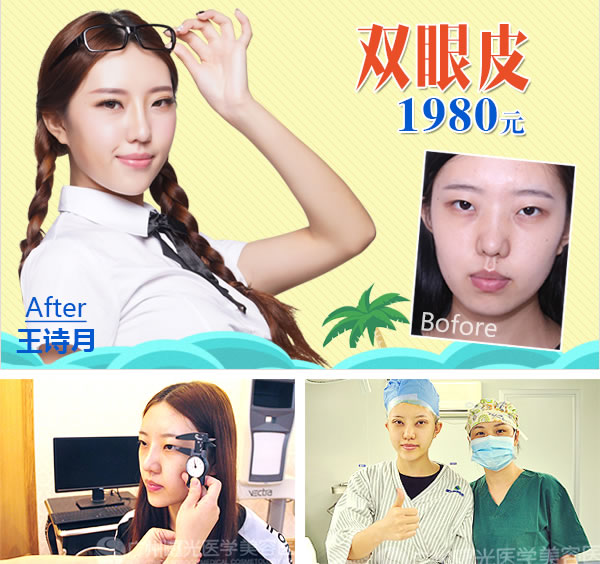 广州曙光双眼皮1980元 广州曙光双眼皮1980元