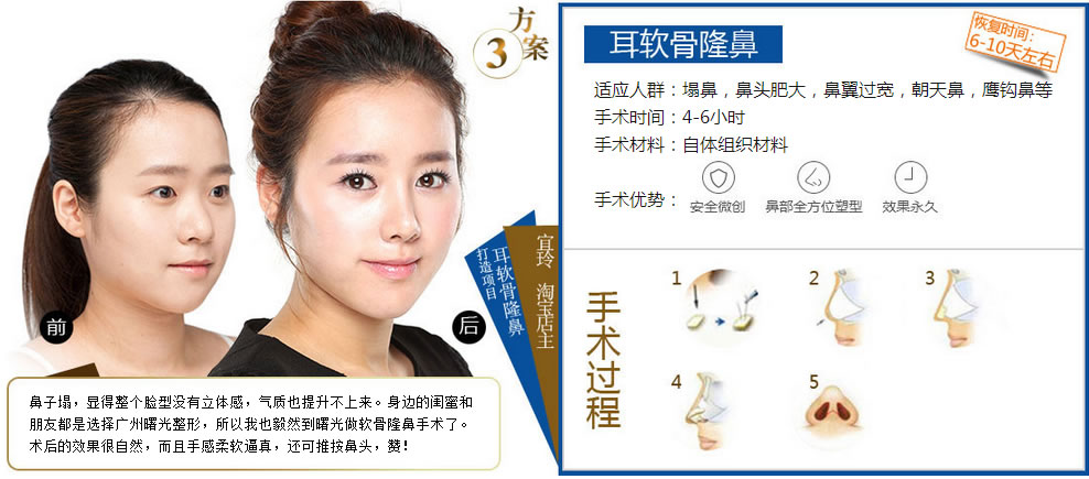 ������¡����Ӧ��Ⱥ�����ǣ���ͷ�ʴ󣬱�������������ǣ�ӥ���ǵ� ����ʱ�䣺4-6Сʱ �������ϣ�������֯����  �������ƣ���ȫ΢�����ǲ�ȫ��λ���Ρ�Ч��