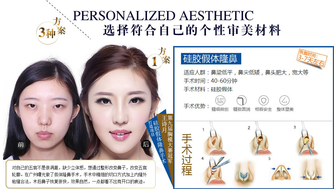 �轺����¡����Ӧ��Ⱥ��������ƽ���Ǽ�Ͱ�����ͷ�ʴ󣬿���� ����ʱ�䣺40-60���� �������ϣ��轺�����������ƣ���ϸ΢��������Բ�����ݰ�ȫ����������