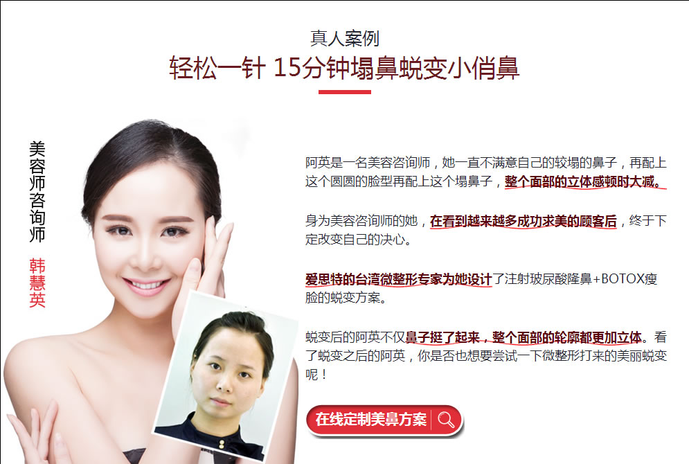 <!--<i data=20240710 data-id=14448></i>-->玻尿酸注射隆鼻案例: <!--<i data=20240710 data-id=14448></i>-->玻尿酸注射隆鼻案例: