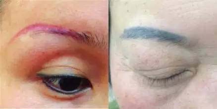 红眉毛和兰眉毛 红眉毛和兰眉毛