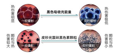 拒绝反黑风险 拒绝反黑风险