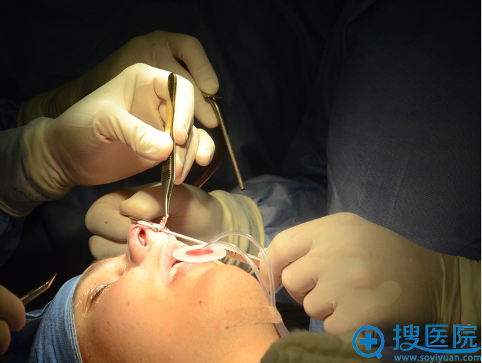 巴西男子正在接受隆鼻手术 巴西男子正在接受隆鼻手术
