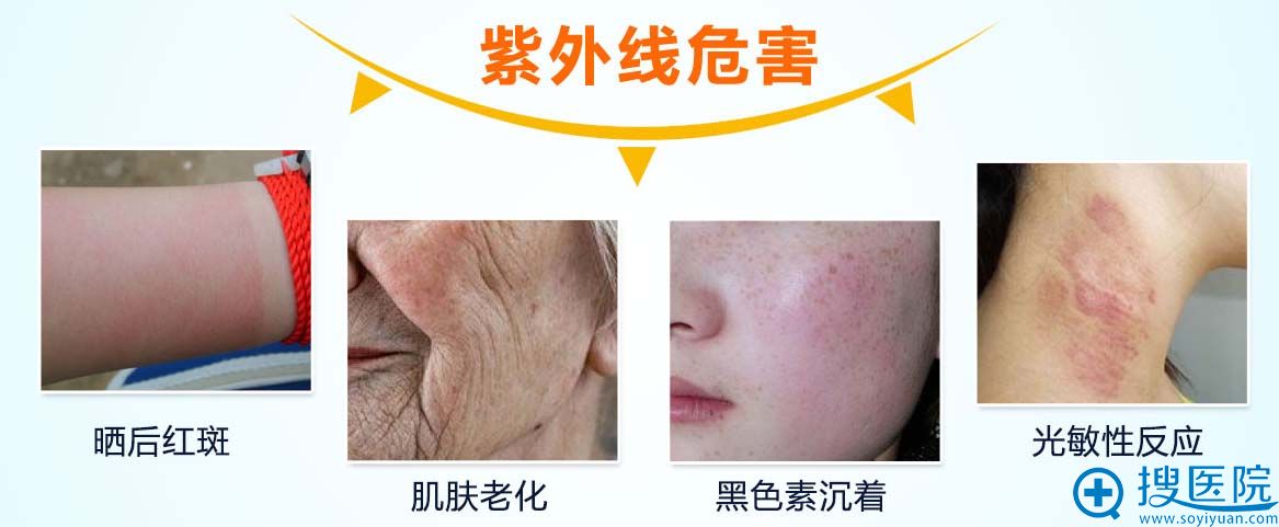 重庆铜雀台还原亮白计划季 抗uv修复万人团购价380元