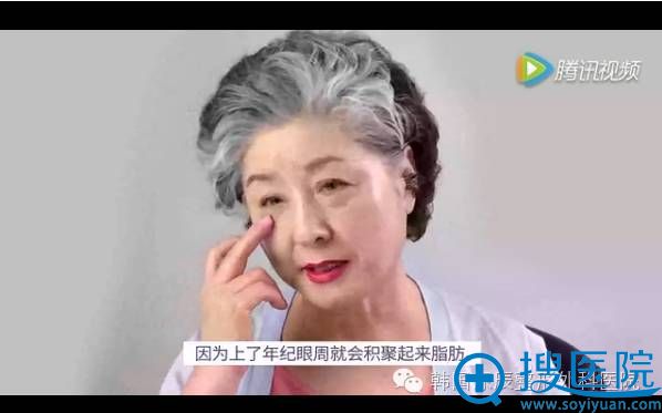 韩国原辰面部提升术助69岁婆婆重拾青春岁月