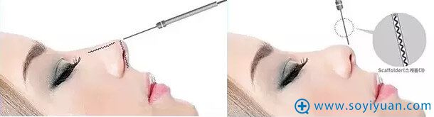 Misko<span style= Misko<span style=