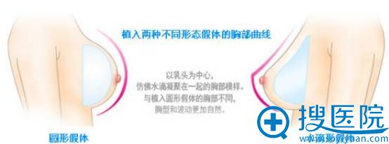 假体有水滴和圆形,可以塑造不同的身体曲线 假体有水滴和圆形,可以塑造不同的身体曲线
