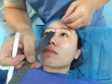 河南整形美容医院鼻综合案例对比 看90后女生变身混血模特