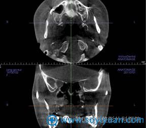 Invivo 5 ׼ȷ�ⶨ������񾭵�λ�ú���̬����ͷ�ĺ�ȡ���̬���Լ���ͷ�Ķ������ܶȡ�