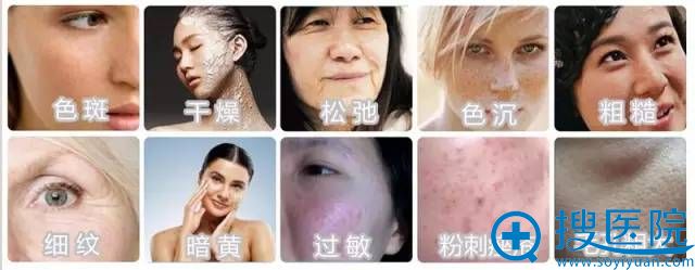 蓝瘦,香菇!西安高一生蜂巢皮秒激光为您解决你这10大皮肤问题