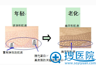 eTwo红电波除皱 无痛无创弹走你的鱼尾纹