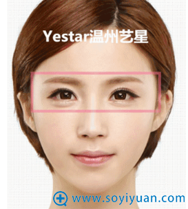 艺星美杜莎综合美眼对比案例之术后效果 艺星美杜莎综合美眼对比案例之术后效果