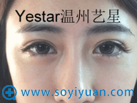 Yestar芭比眼真人案例 Yestar芭比眼真人案例