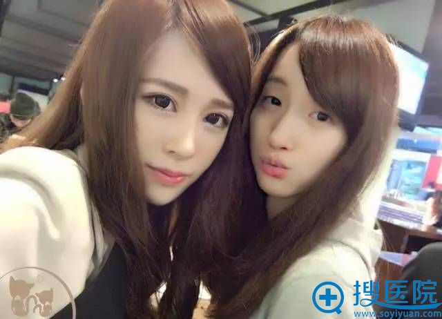 再也不怕和眼睛比你大的人合照 温州艺星整形双眼皮只要2800元