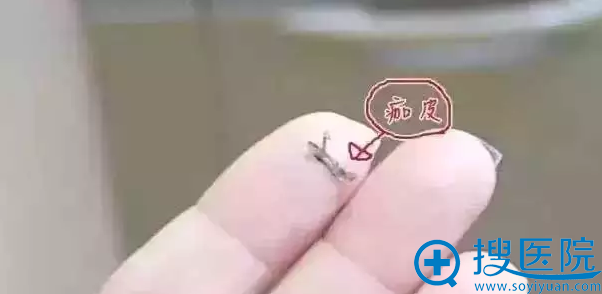�������Ƥ