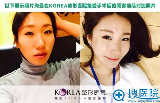 ����KOREA����ҽԺ�����ԱȰ���չʾ