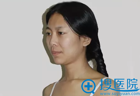 术前照 术前照