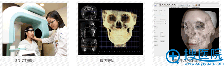 韩国原辰3D颧骨小术手术前有精密的诊断系统 韩国原辰3D颧骨小术手术前有精密的诊断系统