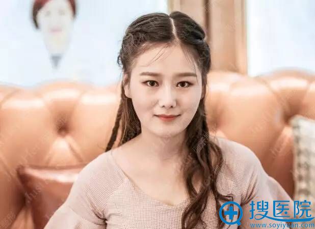 婉婉的鼻整形术后恢复照片展示 婉婉的鼻整形术后恢复照片展示