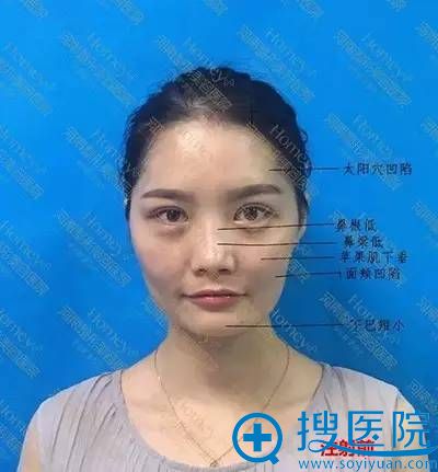 ������������ҽԺ���˰��� ������ȫ�沿�������ӵ��������