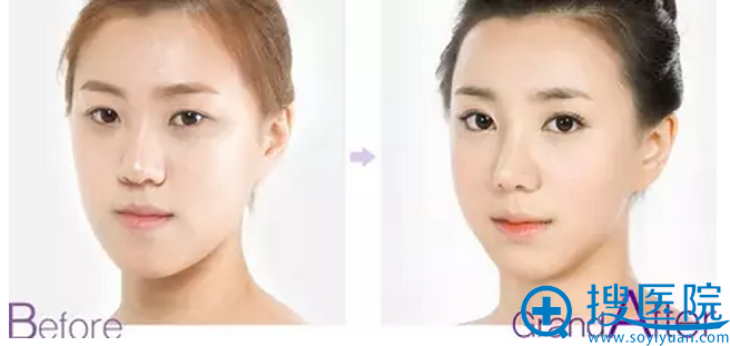 ���컪��˫��Ƥ����
