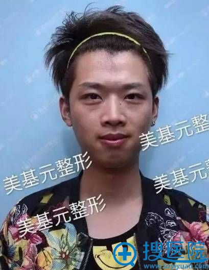 �人����Ԫ���ΰ��� ����֬���沿�����С������Ϯ����ŷ��