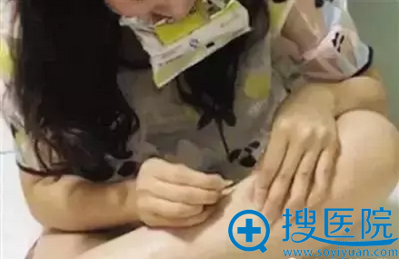 “京韩医美”学员在家中练习在自己大腿上扎针,为忍住疼痛,她口中咬着塑料袋 “京韩医美”学员在家中练习在自己大腿上扎针,为忍住疼痛,她口中咬着塑料袋