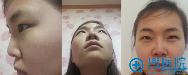����ǰ��Ƭ