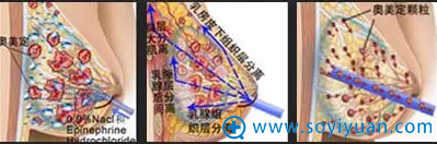 胸部内窥镜三维分层定位取出术流程 胸部内窥镜三维分层定位取出术流程