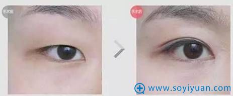 维多利亚MODEL芭比眼0.01毫米精雕 维多利亚MODEL芭比眼0.01毫米精雕