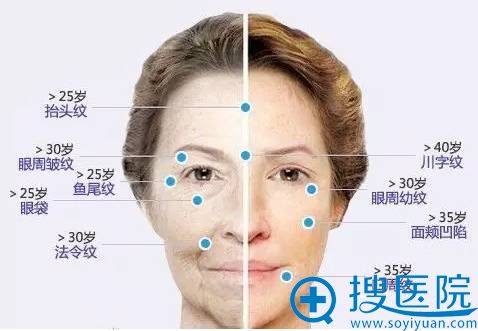 终身免费!无限畅打 深圳非凡美国终身祛皱免费年卡8000元