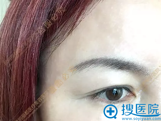 李院长未做纹绣前的眉毛长是长这样滴 李院长未做纹绣前的眉毛长是长这样滴