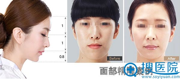 �沿����